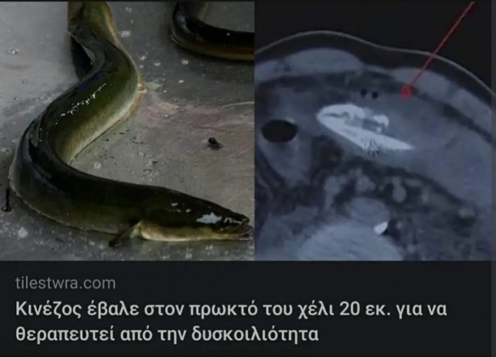 Για λόγους υγείας 🤡